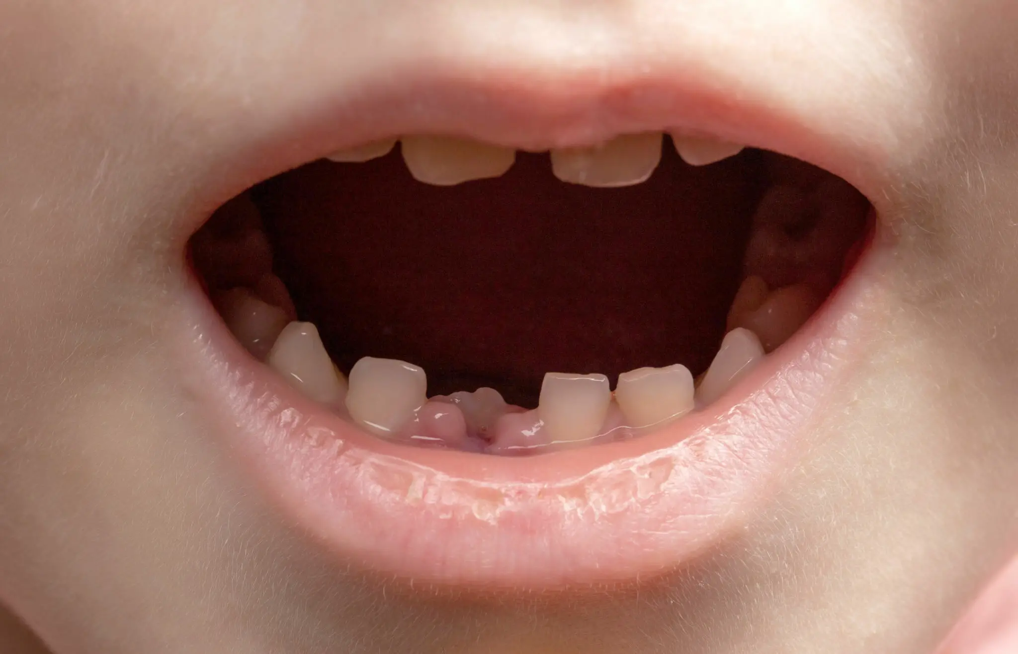 Mơ thấy rụng răng đánh con gì chuẩn nhất? Mơ thấy rụng răng đánh số nào may mắn?